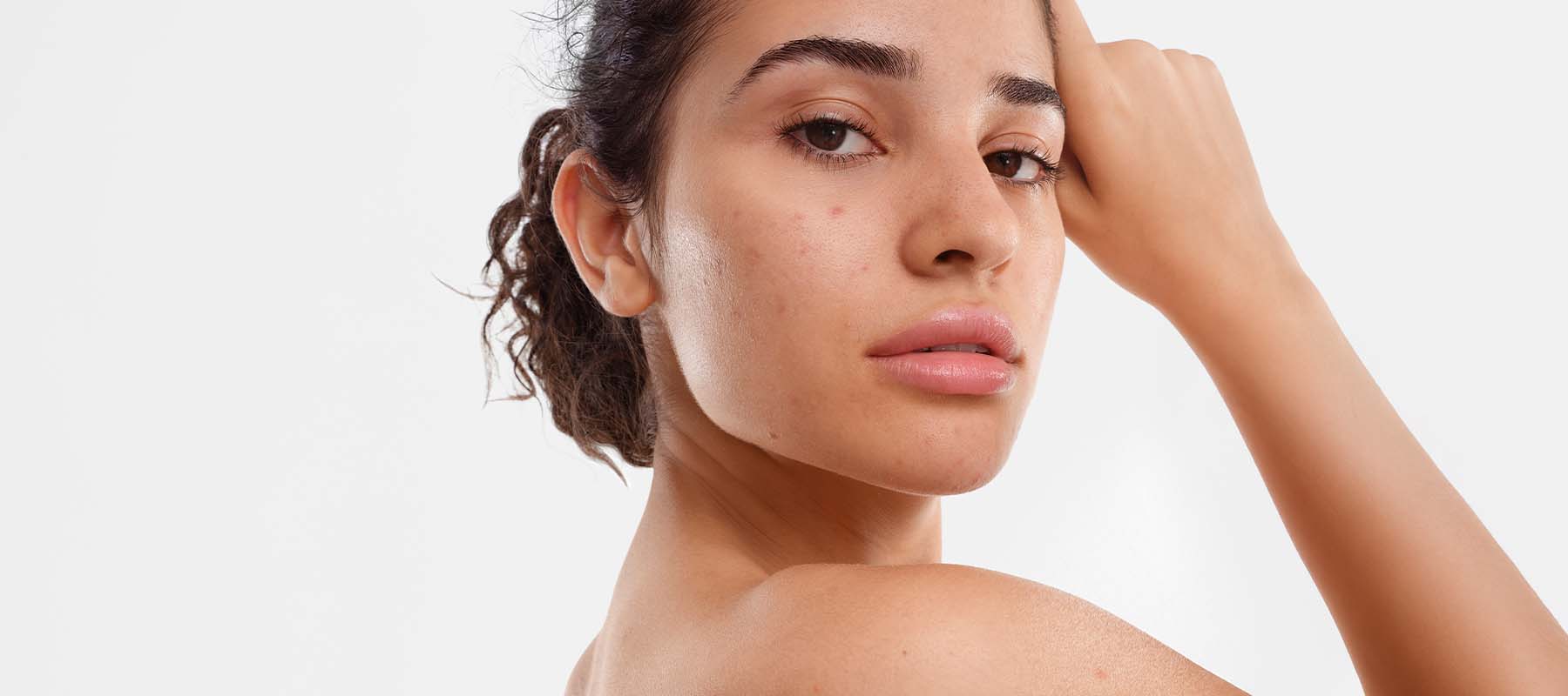 Learn what body acne is, what causes it, and how to treat it effectively.