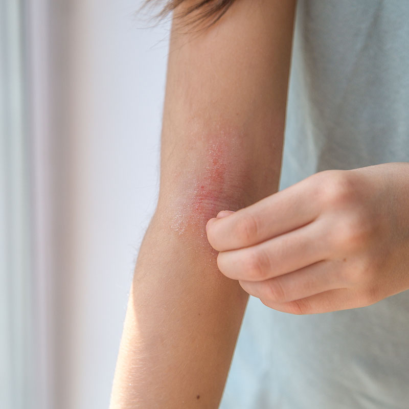 sensitive skin image