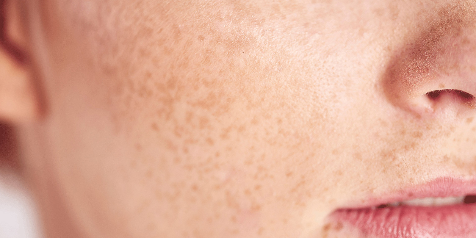 sensitive skin face