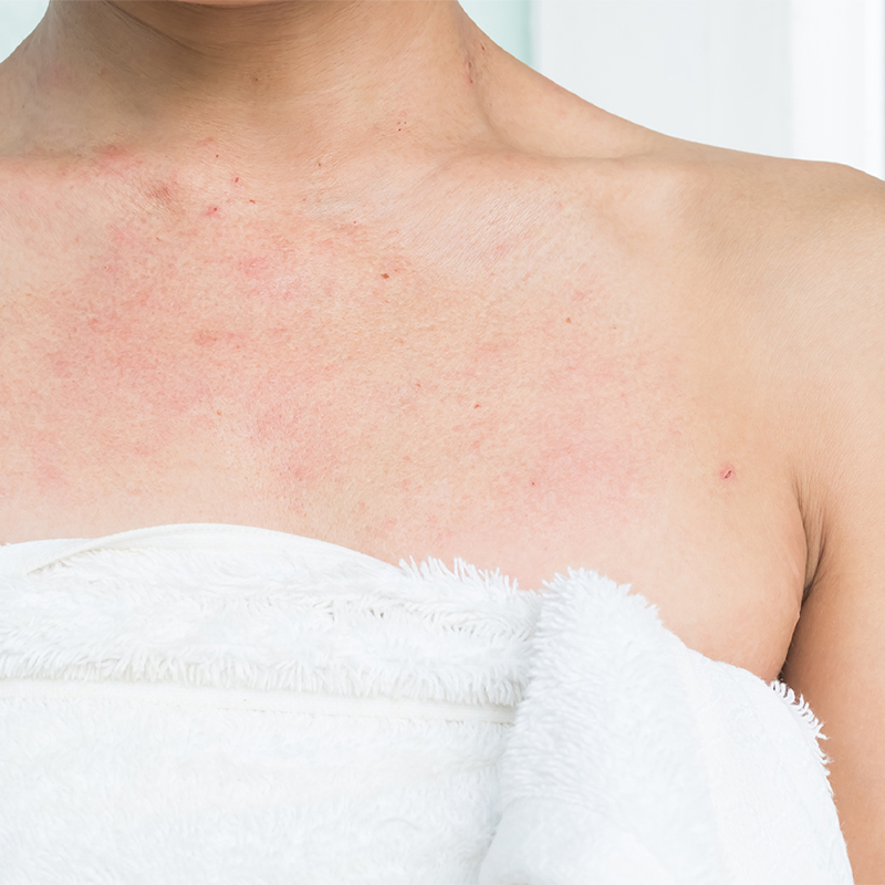 sensitive skin image