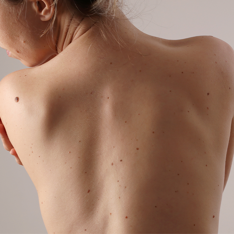 sensitive skin image