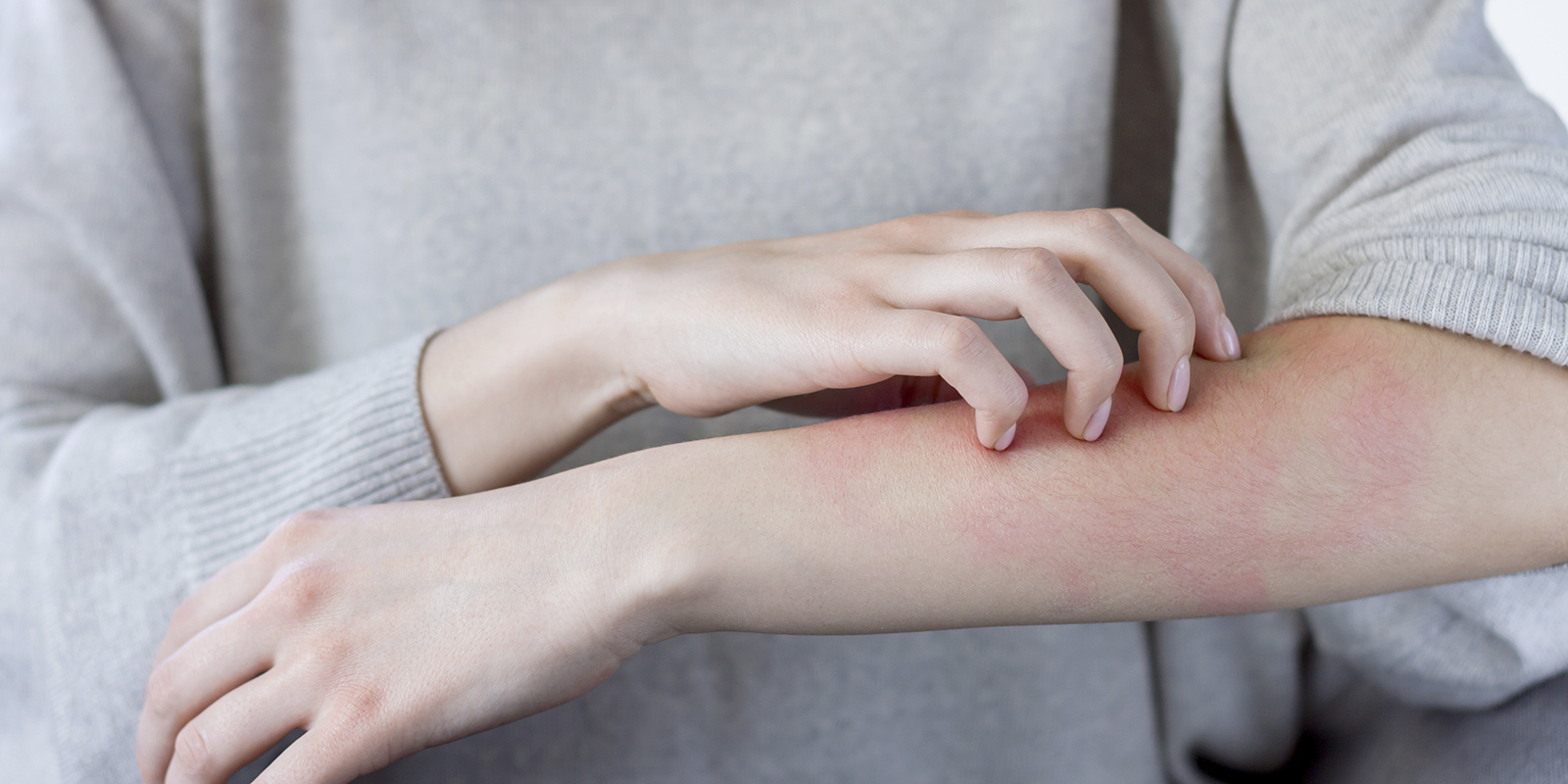 Sensitive skin image